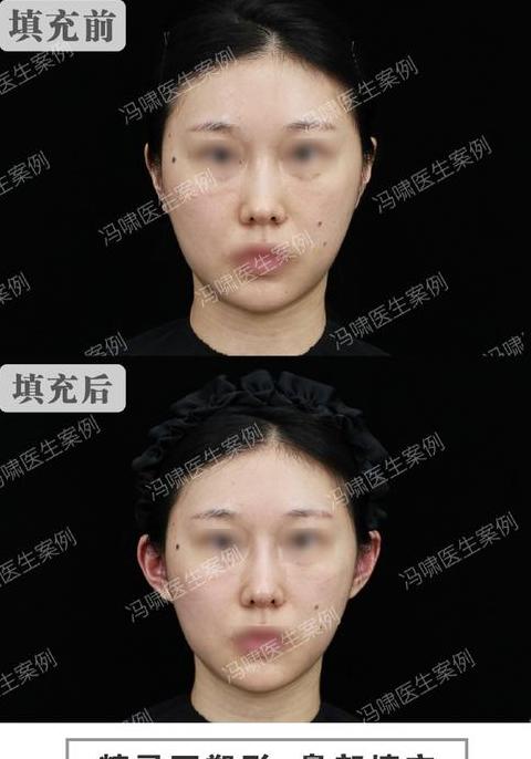 上镜显胖揭秘：镜头下的身材真相